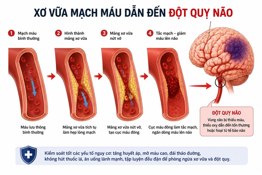/images/companies/benhvienducgiang/images/2026/tháng 6/tkinh.jpg
